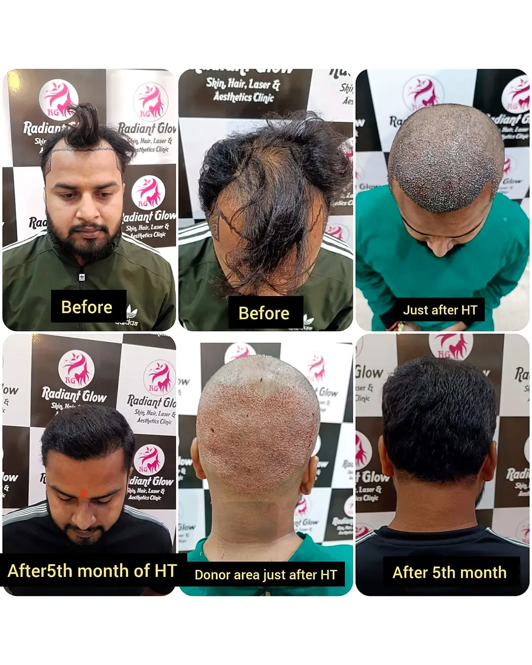 Best hair loss treatment near me