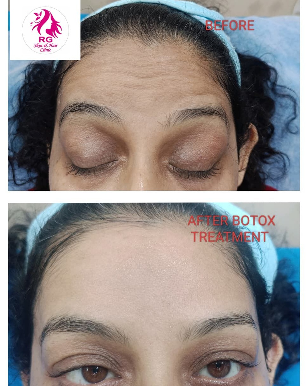 Best Anti-Ageing treatment near me