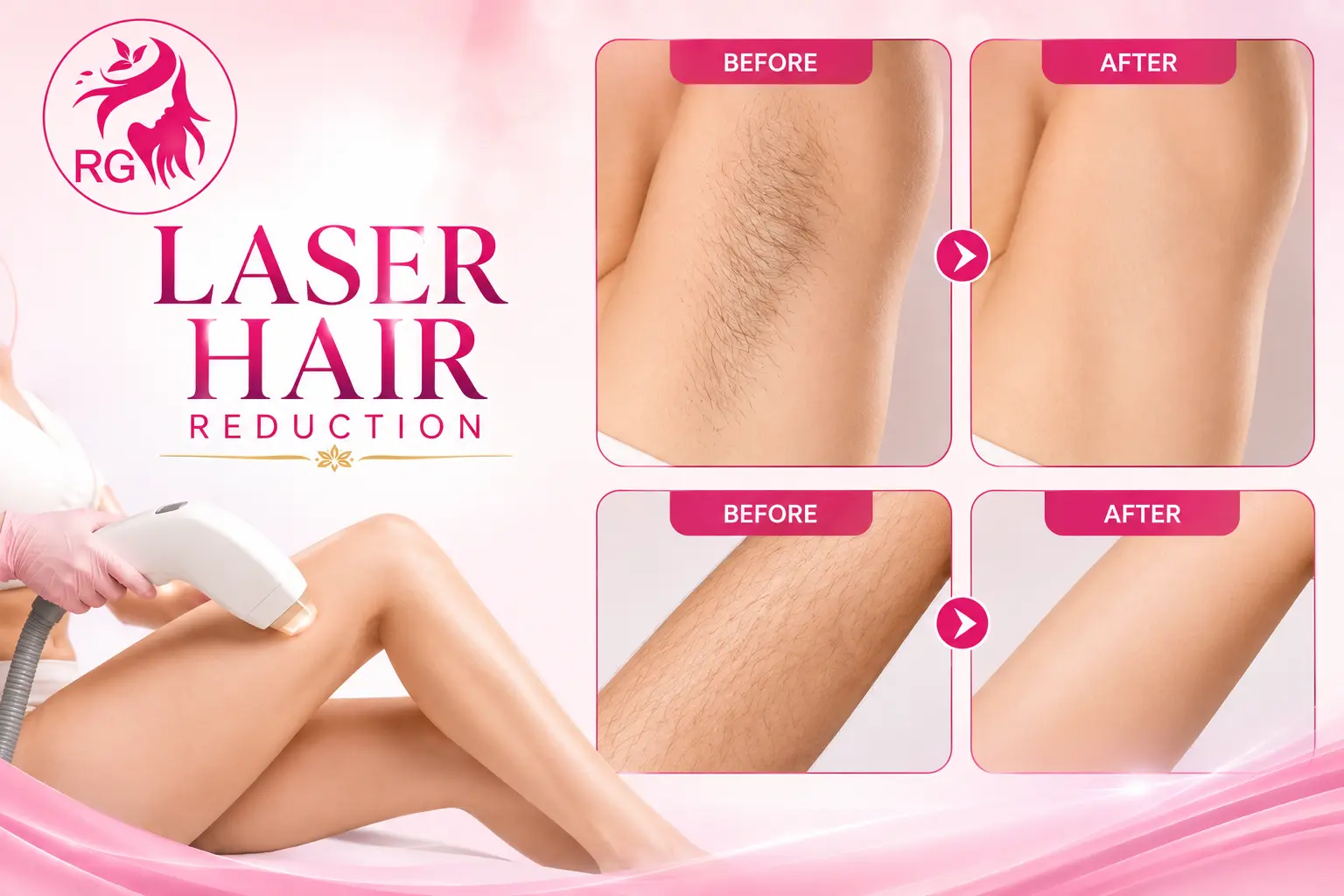 Best Laser treatment in Lucknow